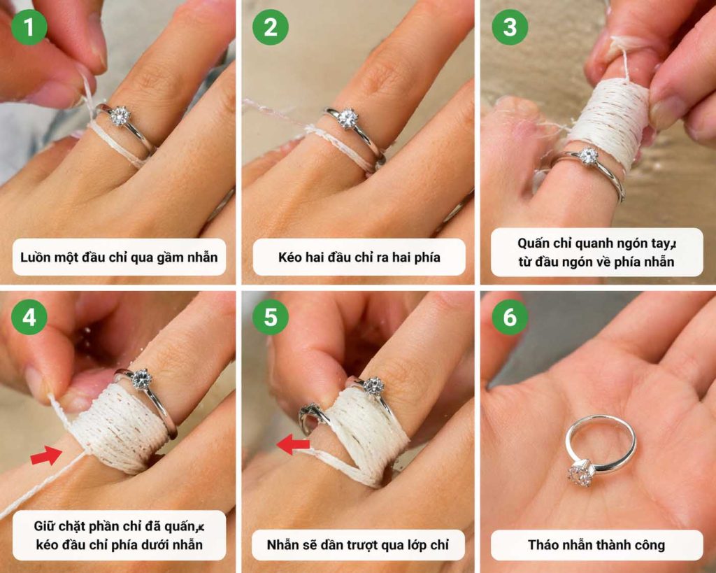 Cách tháo nhẫn bị kẹt bằng chỉ nha khoa quấn quanh ngón tay