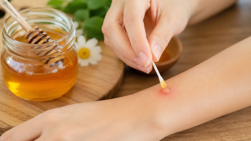 Thoa mật ong lên vết côn trùng cắn để giảm ngứa và kháng khuẩn