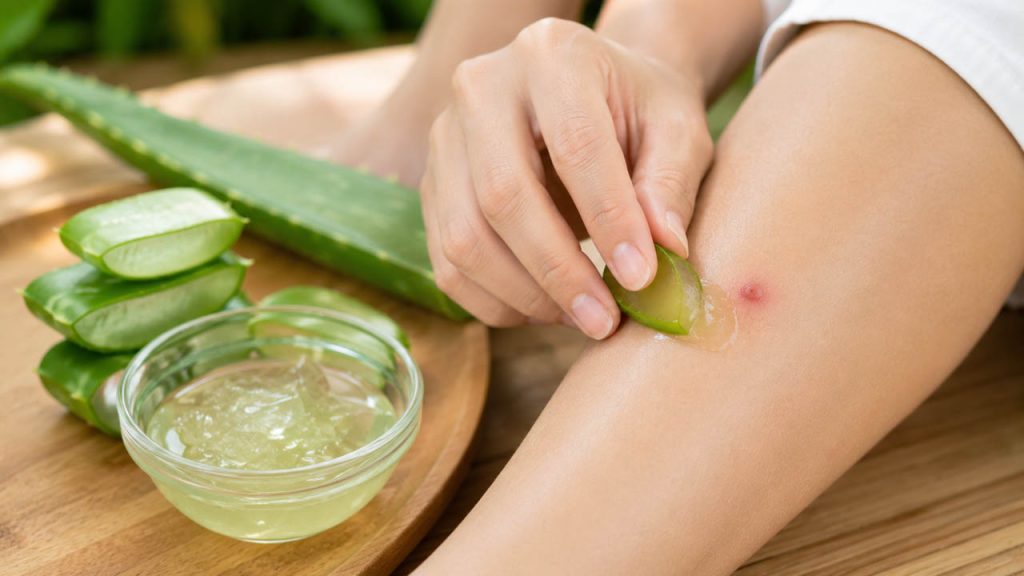 Dùng nha đam làm dịu vết côn trùng cắn và giảm ngứa trên da
