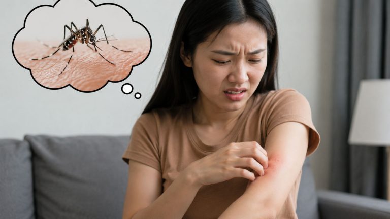 Mẹo giảm ngứa khi bị muỗi đốt bằng những cách đơn giản và hiệu quả tại nhà